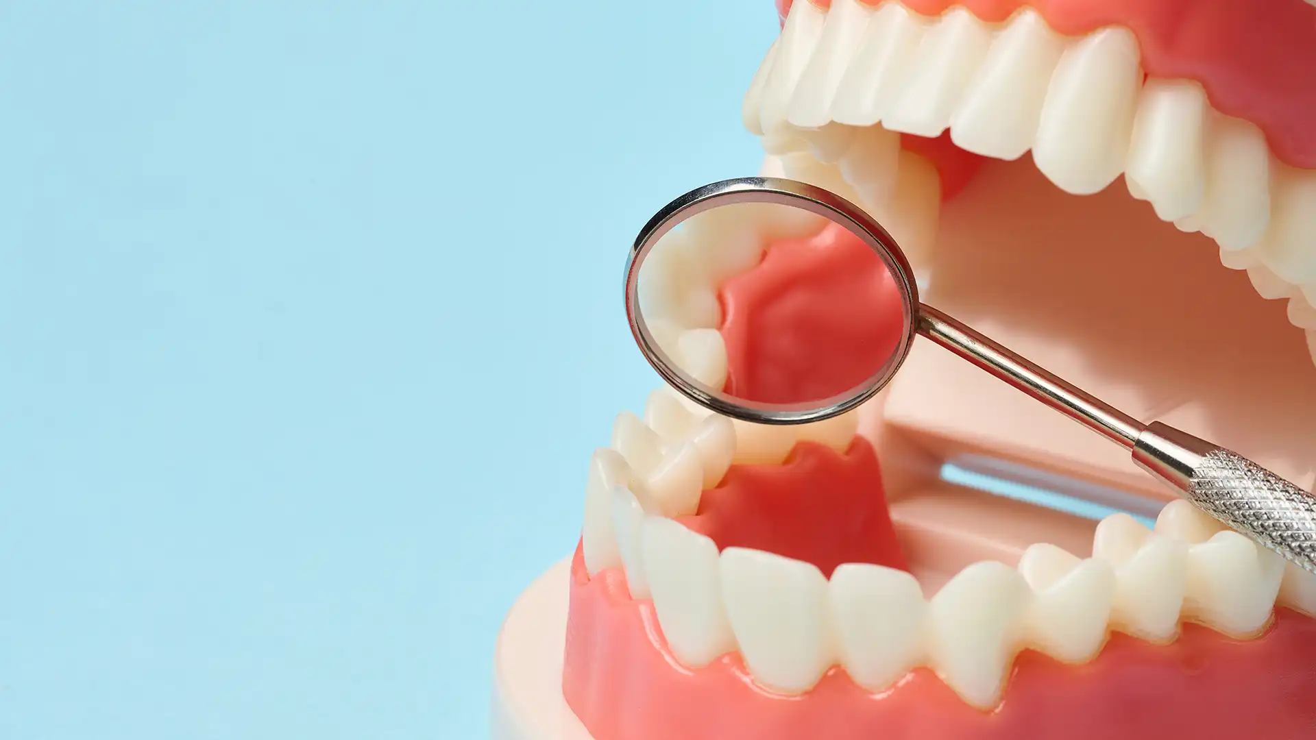 jawbone loss and dental implants